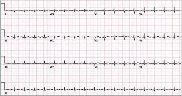 Valid Test ANVE Braindumps